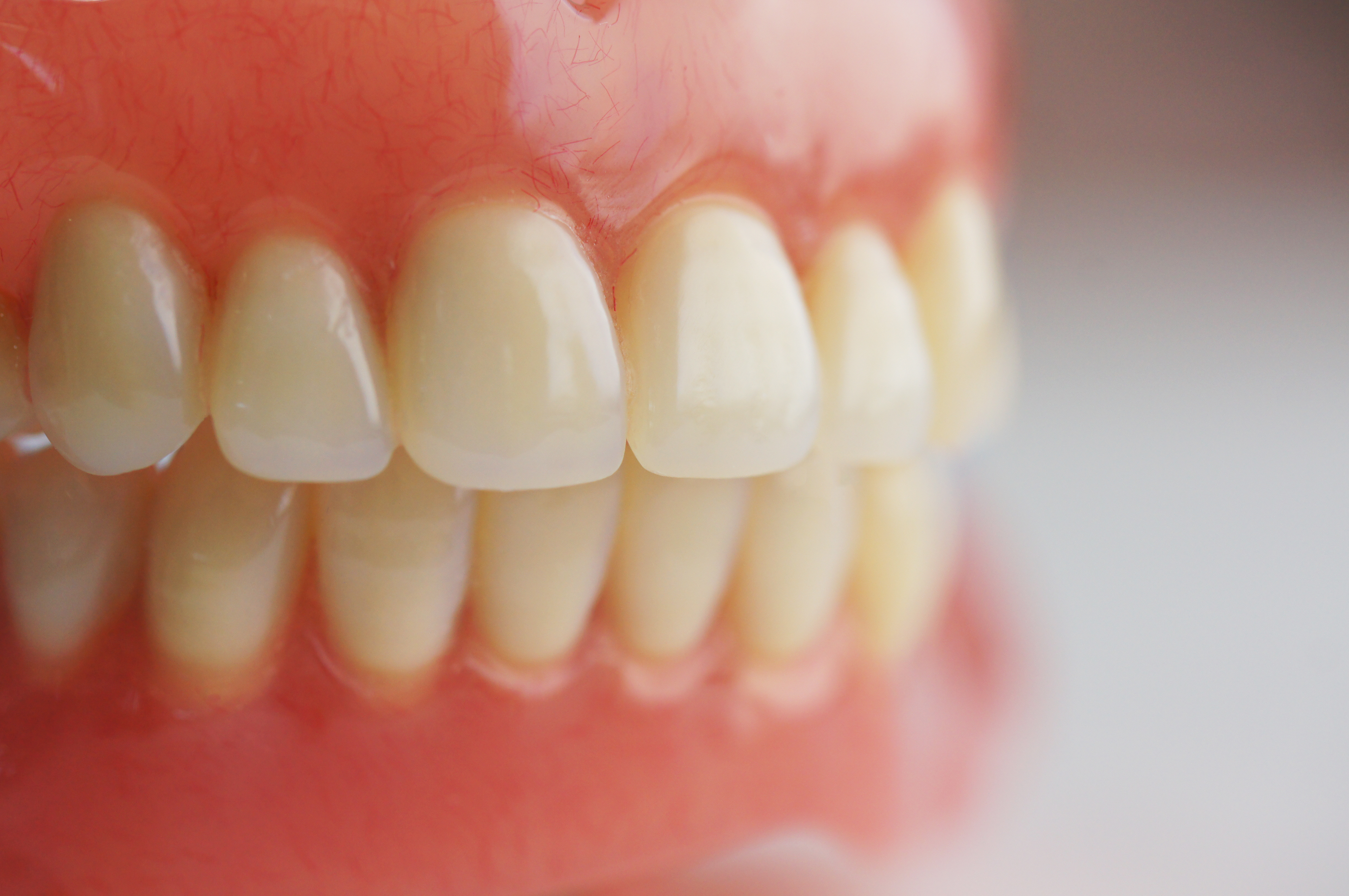 Full Dentures | Trojan Denture Clinic - Free Consultation!